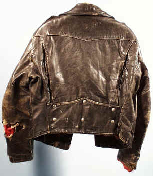 Sears with road rash!